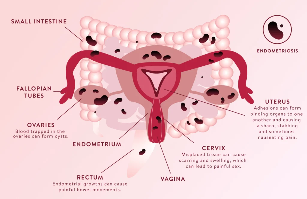 Dr Rami Wakim, fertility specialist with 25+ years in IVF & advanced reproductive treatments. Schedule your appointment today. English, French & Arabic spoken.